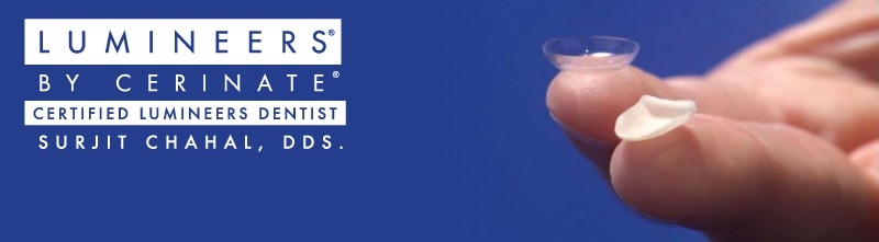 Certified Turlock dentists offering Lumineers by Certinette, a trusted brand for dental veneers.