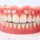 Close-up of a tooth showcasing gaps, highlighting the need for dentures or partial dentures for restoration.